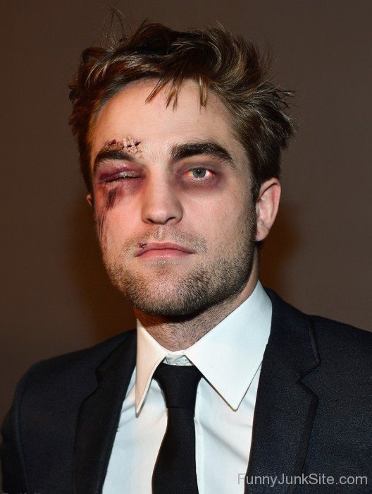 Beaten Up Robert Pattinson