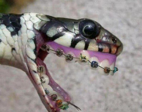 Funny Snake Wearing Braces